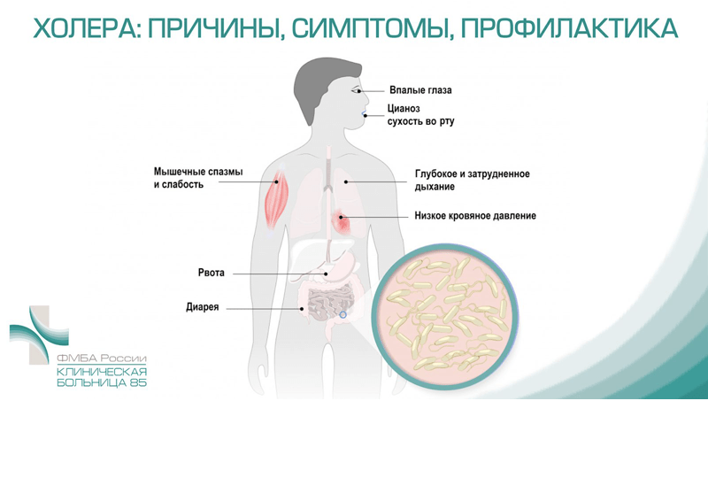 Холера заболевание вызываемое. Холера симптомы профилактика. Холера причины симптомы профилактика.