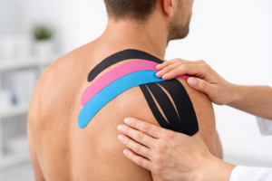 Тейпирование